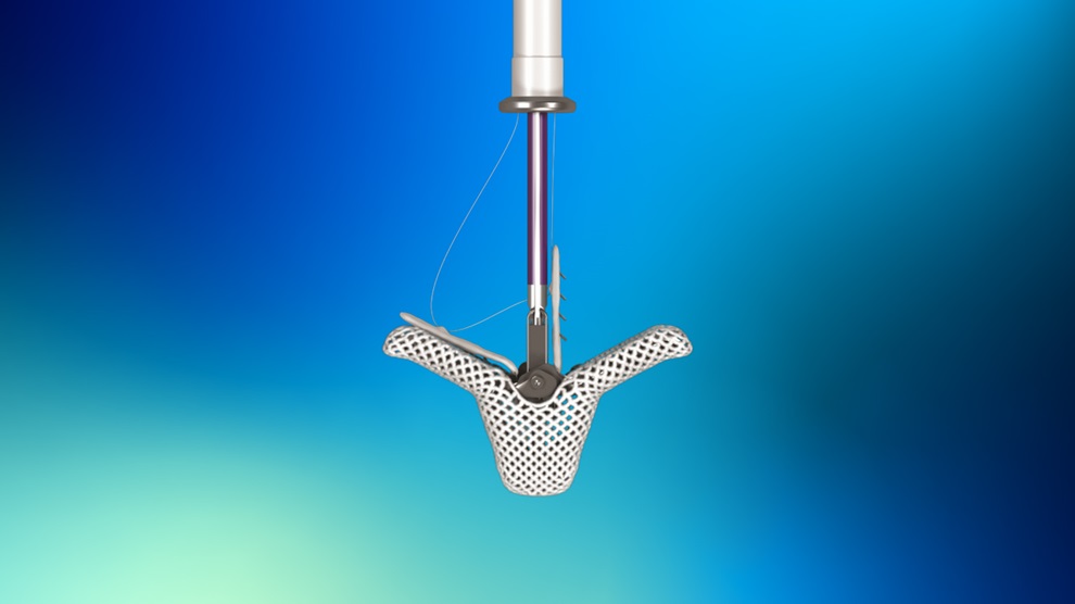 Image: The TriClip device to repair leaky tricuspid heart valve has received FDA approval (Photo courtesy of Abbott)